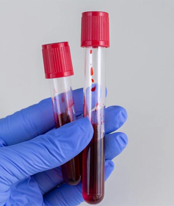 lab test home collection